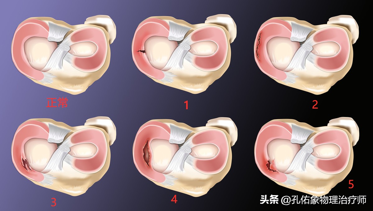 膝关节疼痛需不需要重视,膝盖疼痛不要忍
