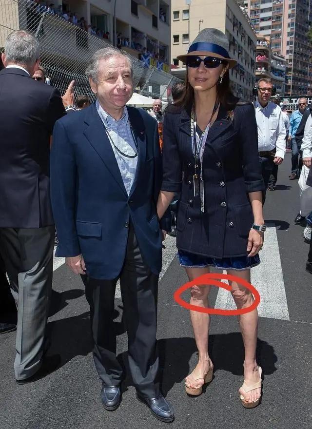 当代女性“酷刑”之首，终于要消失了？