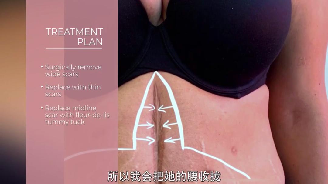 整容能弄成明星的样子吗,整容真的能整漂亮吗