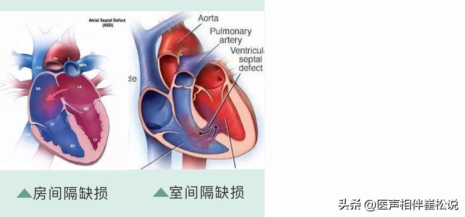 这份心脏说明书请收好,心脏保健手册