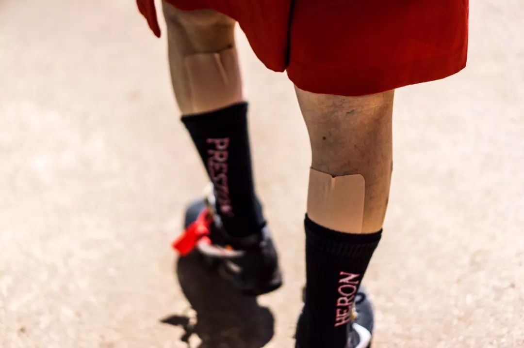 85岁的老人流鼻血,大爷现场流鼻血