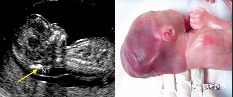 产科常规彩色超声报告单介绍,常见妇科疾病超声报告