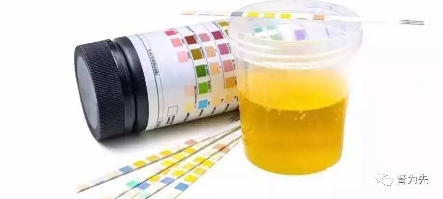 尿蛋白减少但是肾病变严重了,检查尿蛋白为什么必须中段尿