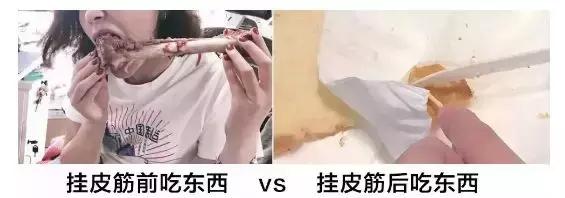 戴一个牙套牙会黑吗,戴个牙套有什么用处