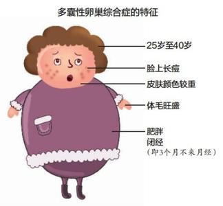 判断易孕体质最简单的方法,5招养成易孕体质你能做到几个