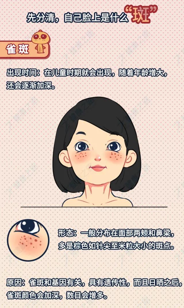 祛斑用祛斑产品好还是激光祛斑好 (祛斑后可以用什么祛斑产品)