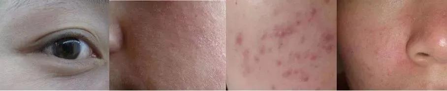 买一送一颐莲玻尿酸补水喷雾新品 (颐莲玻尿酸水乳买一送一)