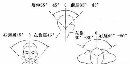 过山车导致脖子不舒服怎么办,女孩玩过山车意外变成了怪物