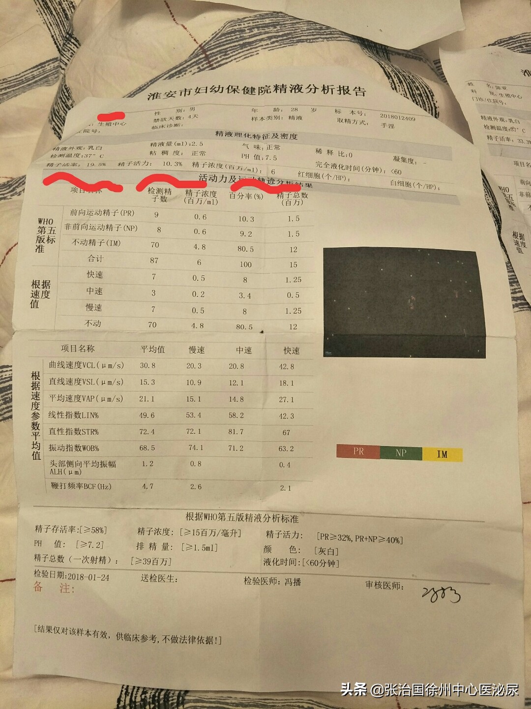 一次精子检测无精严重吗,一次精子检测确定无精子症吗