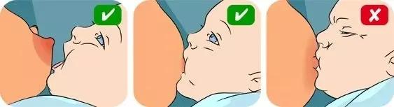 乳房硬块哺乳期吃什么药,哺乳期乳房结块像石头