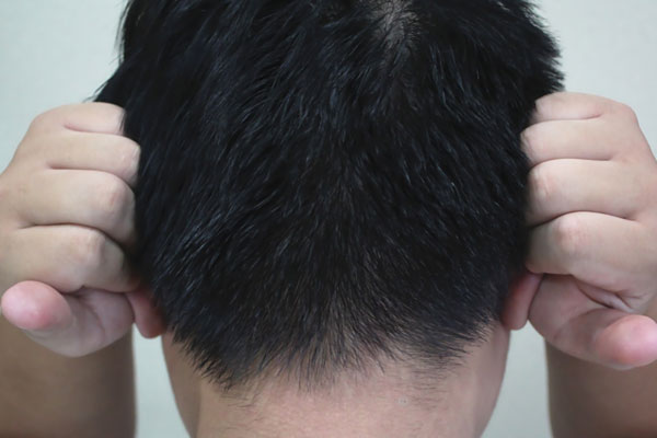 油耳朵就一定有狐臭吗几岁会有,油耳朵孩子会在几岁开始出现狐臭