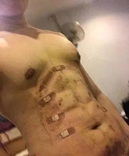 泰国网红花巨资整容30次,泰国网红花费百万整容