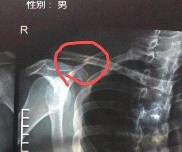 孙兴慜伤病球迷反应,孙兴慜什么伤