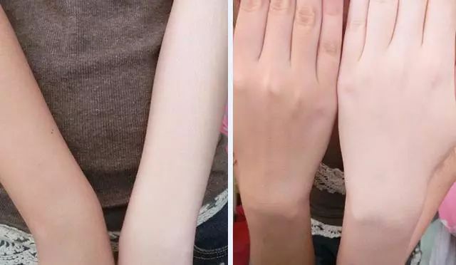 夏天肤色黑怎么办,黑黄暗沉肤色改善