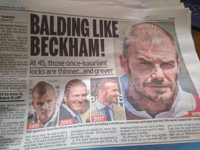 小贝为何剃光头,贝克汉姆的头秃