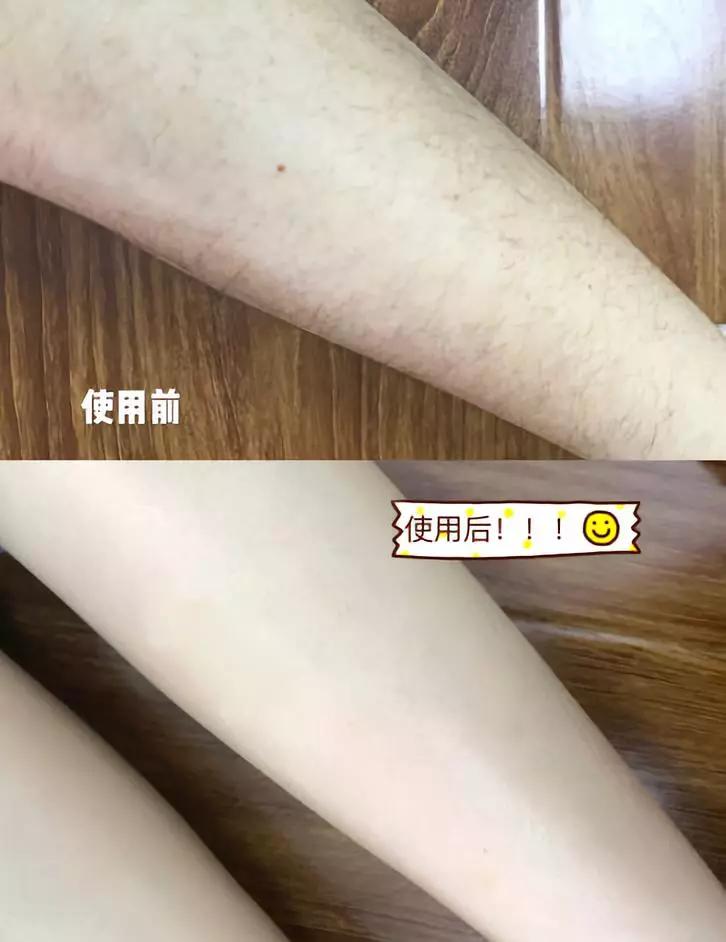 日本妹子人手一只的CM脱毛膏，脱毛膏销售榜冠军有什么关注事项？