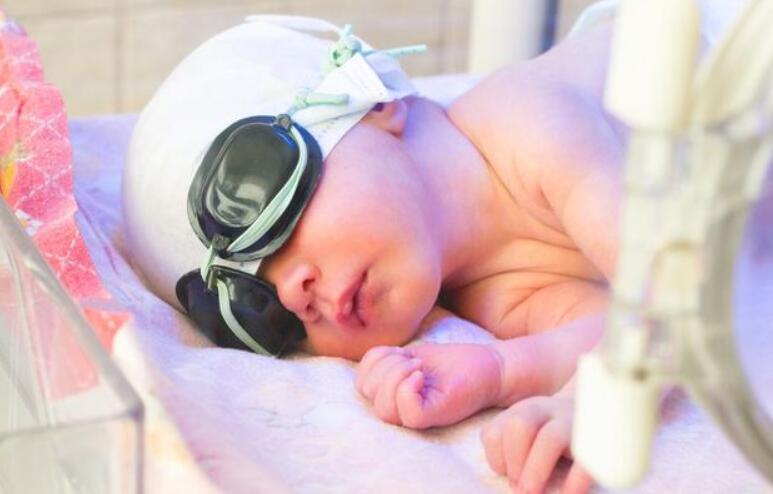 新生儿黄疸严重应该要关注些什么,新生儿黄疸如何去得快一招搞定