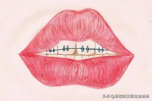 在山东做牙齿矫正去哪里好,16岁牙齿太稀牙小缝大怎么矫正