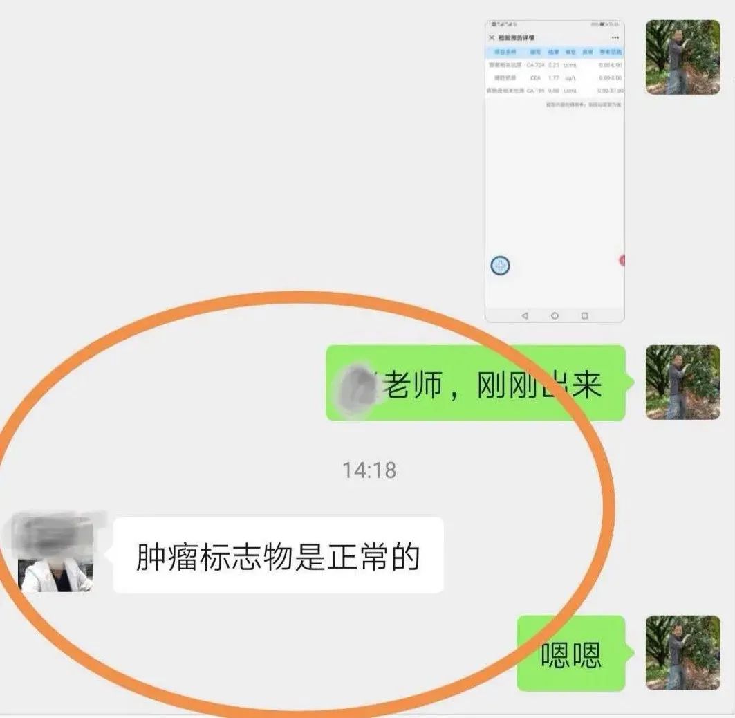 胃癌已转移到腹膜了严重吗,胃癌晚期转移到肝导致肝昏迷