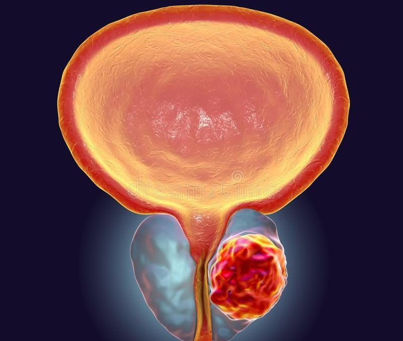 导致尿黄的各种原因,解小便感到小便烫是什么原因