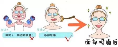 瘦脸脸大,脸大胖10斤这个方法瘦脸超有效