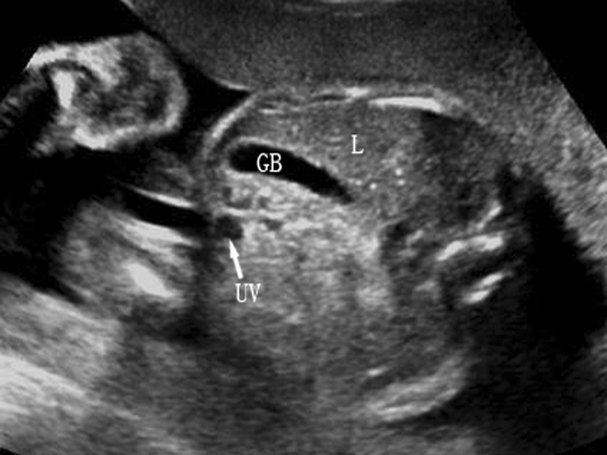 孕期不能忽视的胎儿超声检查,胎儿超声检查报告表