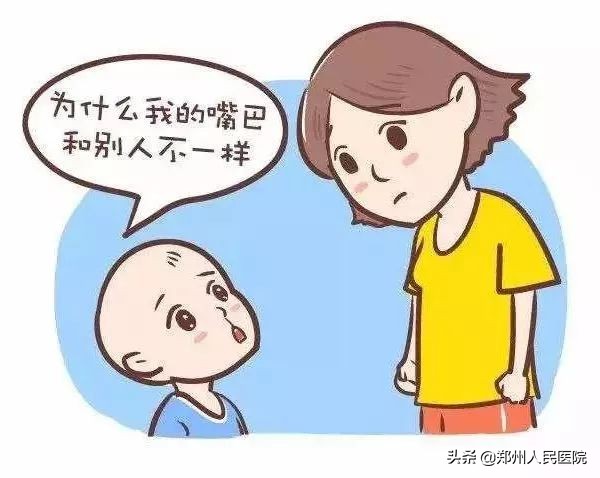 严重唇腭裂修复效果,唇裂修复对比照片