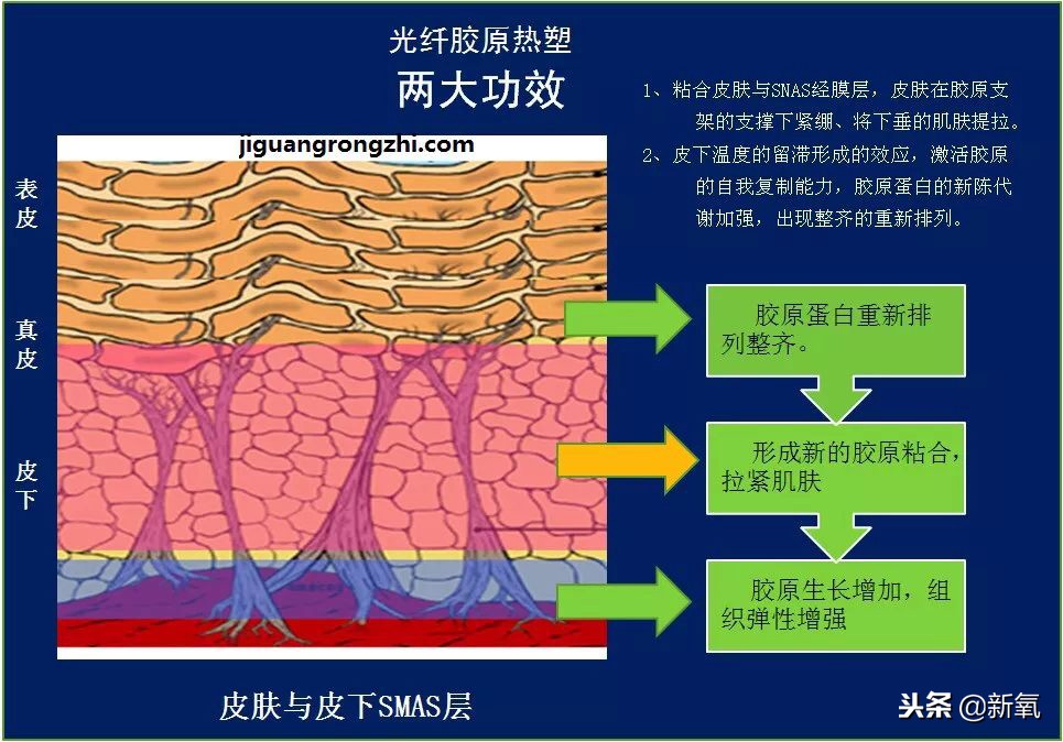 辛芷蕾是苦相女生吗,辛芷蕾气质怎么养成
