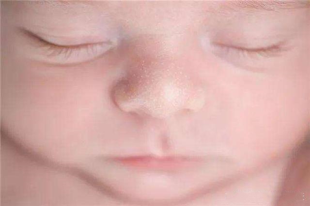 害怕宝宝睡觉受惊？看完后家长再也不用担心宝宝的这几种生理现象