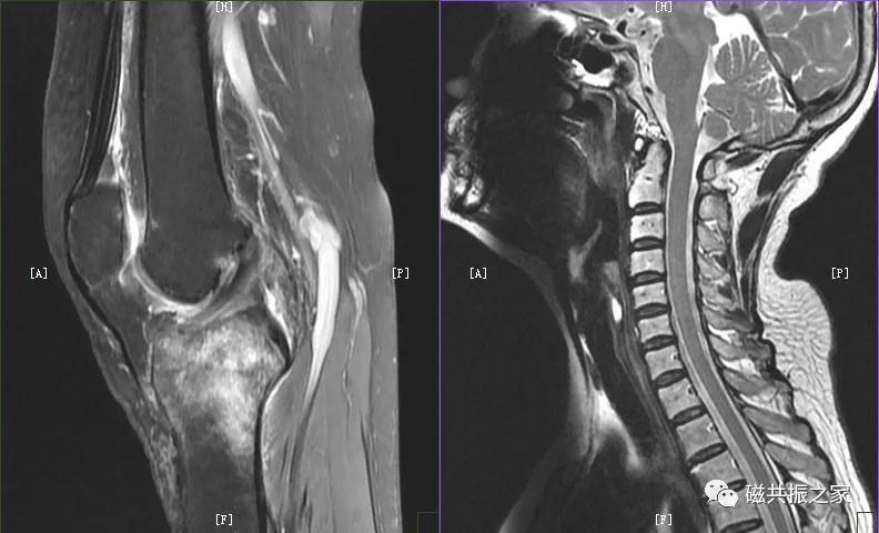 mri知识,mri讲解科普