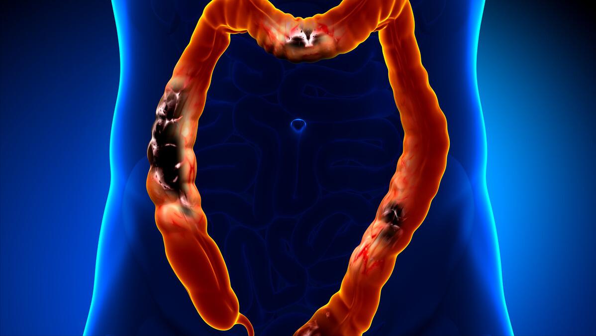 一天排便好几次一直有便意,每天排便几次最正常