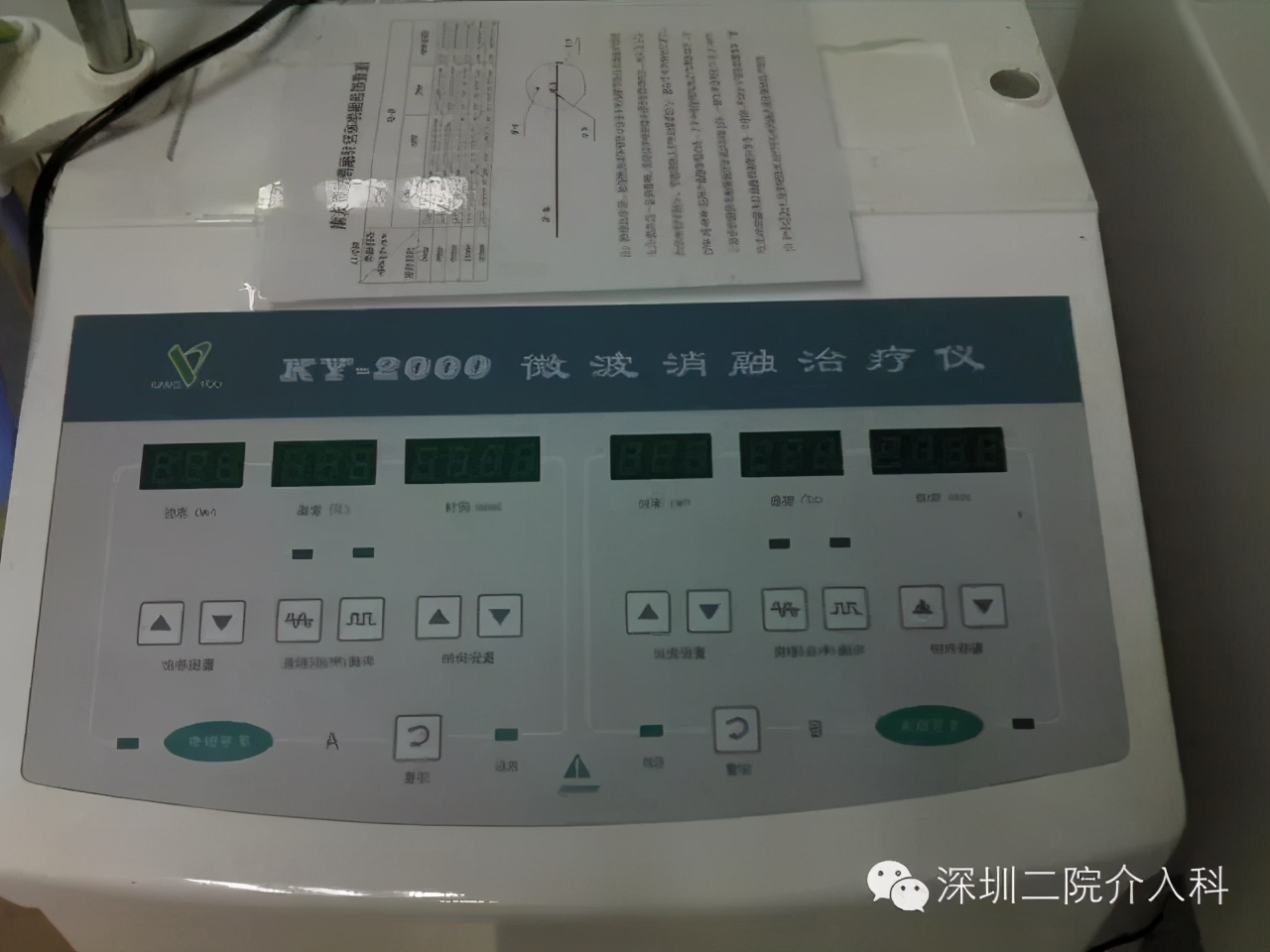 “冬季里的一把火”——恶性肿瘤的微波消融术