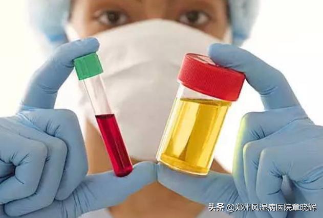 痛风的十大误区不得不看,痛风的100个误区
