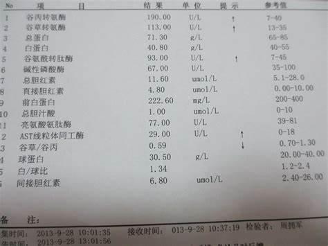 谷丙转氨酶高影响录用吗,体检谷丙转氨酶升高怎么回事