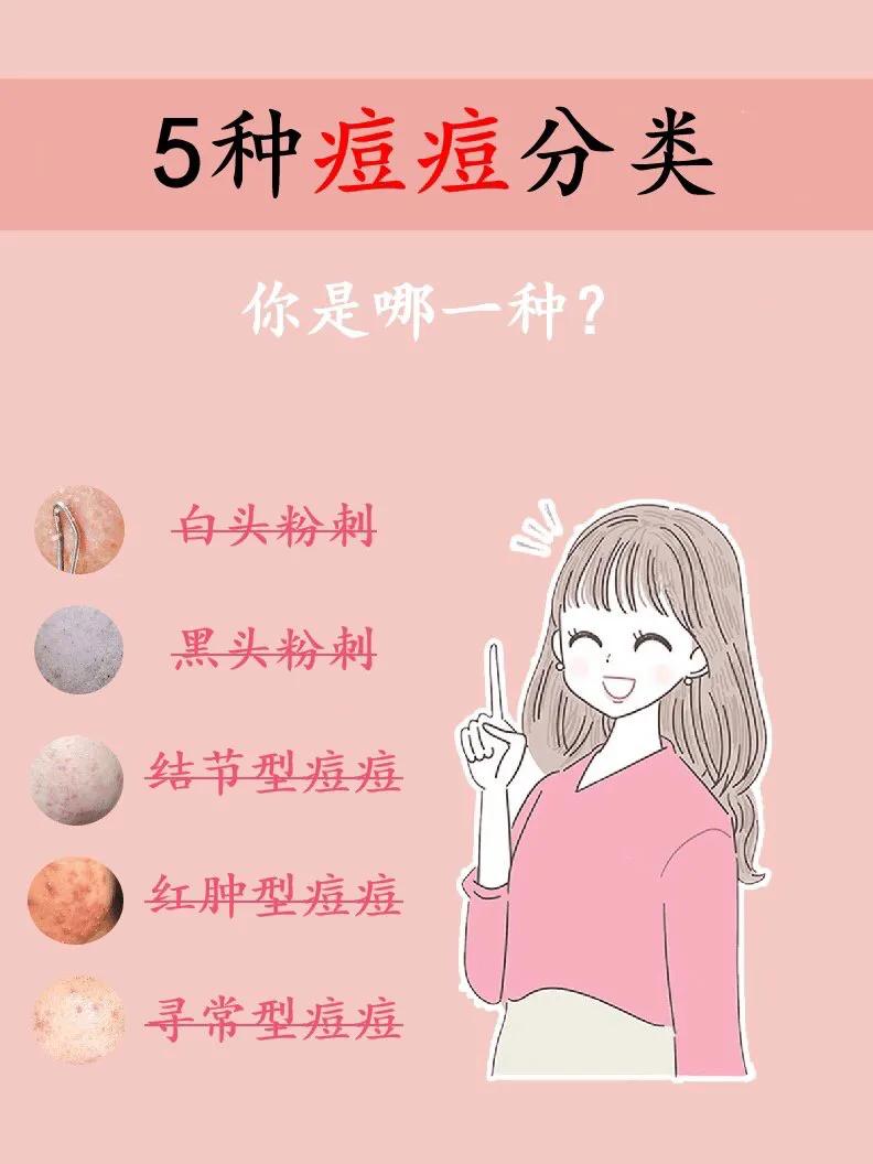 各种类型痘痘,可以针清的痘痘类型