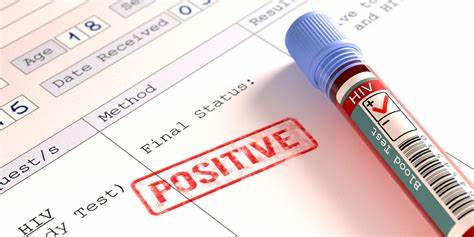 艾滋病咽痛与普通咽痛区别,hiv急性感染期咽痛会单独出现吗