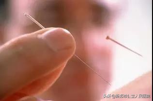 面瘫不是想得就得的,面瘫一点风都不能吹吗
