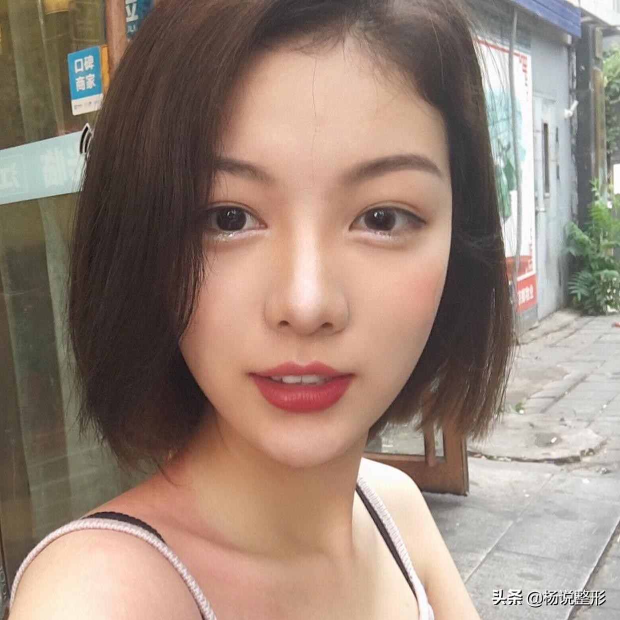 28岁做线雕提升脸部好不好,28岁女人做线雕现状