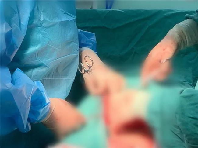 生死时速救失血产妇,胎盘早剥抢救6分钟跑赢死神