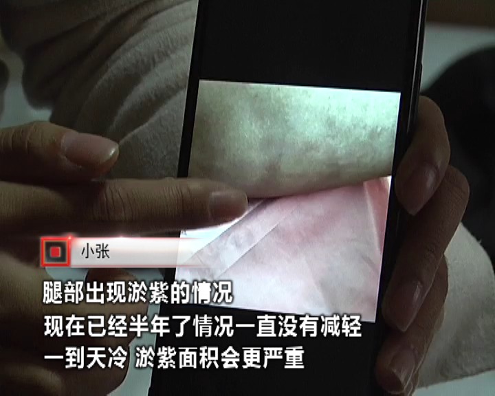 女子花费一万五千元抽脂,女子花三万抽脂术后效果引争议