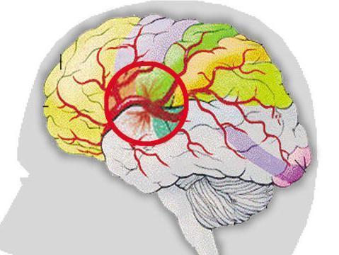 麻醉术后苏醒延迟,麻醉后苏醒延迟是怎么回事