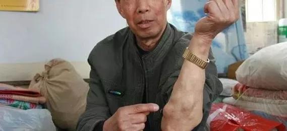 身上长很多包是什么癌,身上长包块去什么医院