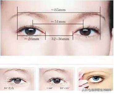 眼睛手术的坑，不要往里面跳了