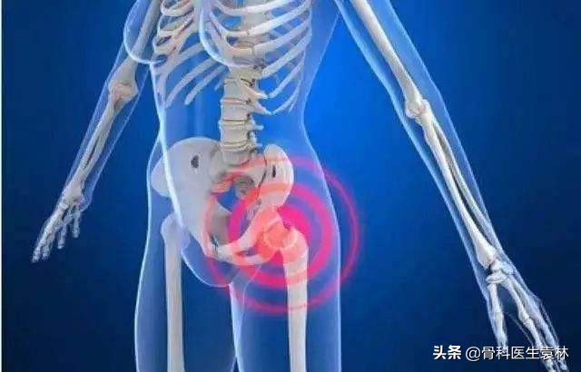 髋关节疼痛是什么原因引起的,老年女性髋关节疼痛是怎么回事