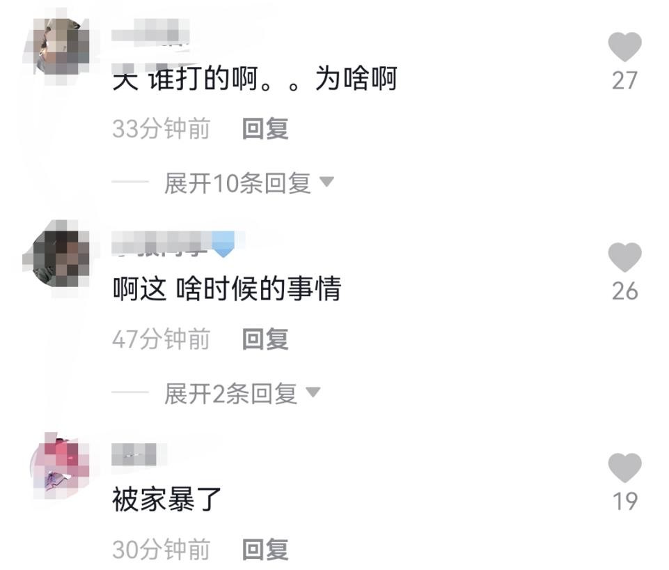 抖音被家暴戴眼镜的男网红,网红被家暴事情