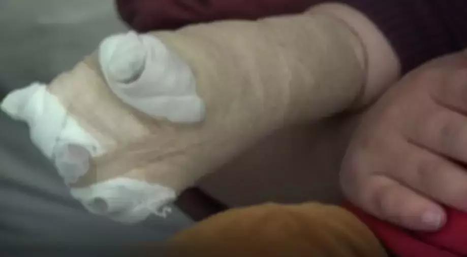 电动车充电口会有火花影响电瓶吗,电动车充电时会不会电人