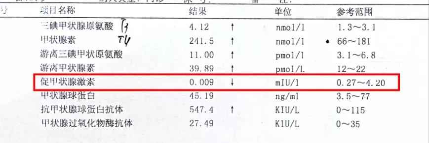 23岁女孩患甲亢的真实案例,孩子一岁三个月妈妈检查出甲亢