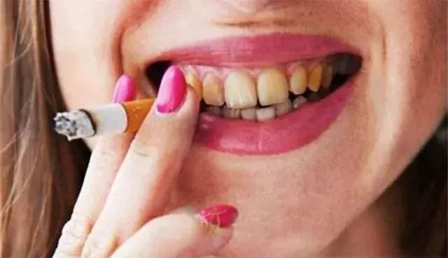 牙上有黑黑的东西又很疼,牙上有黑东西咋回事