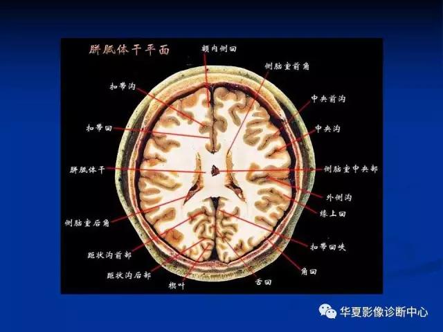 mra头颅解剖学详细讲解视频,常见的头颅mri图像