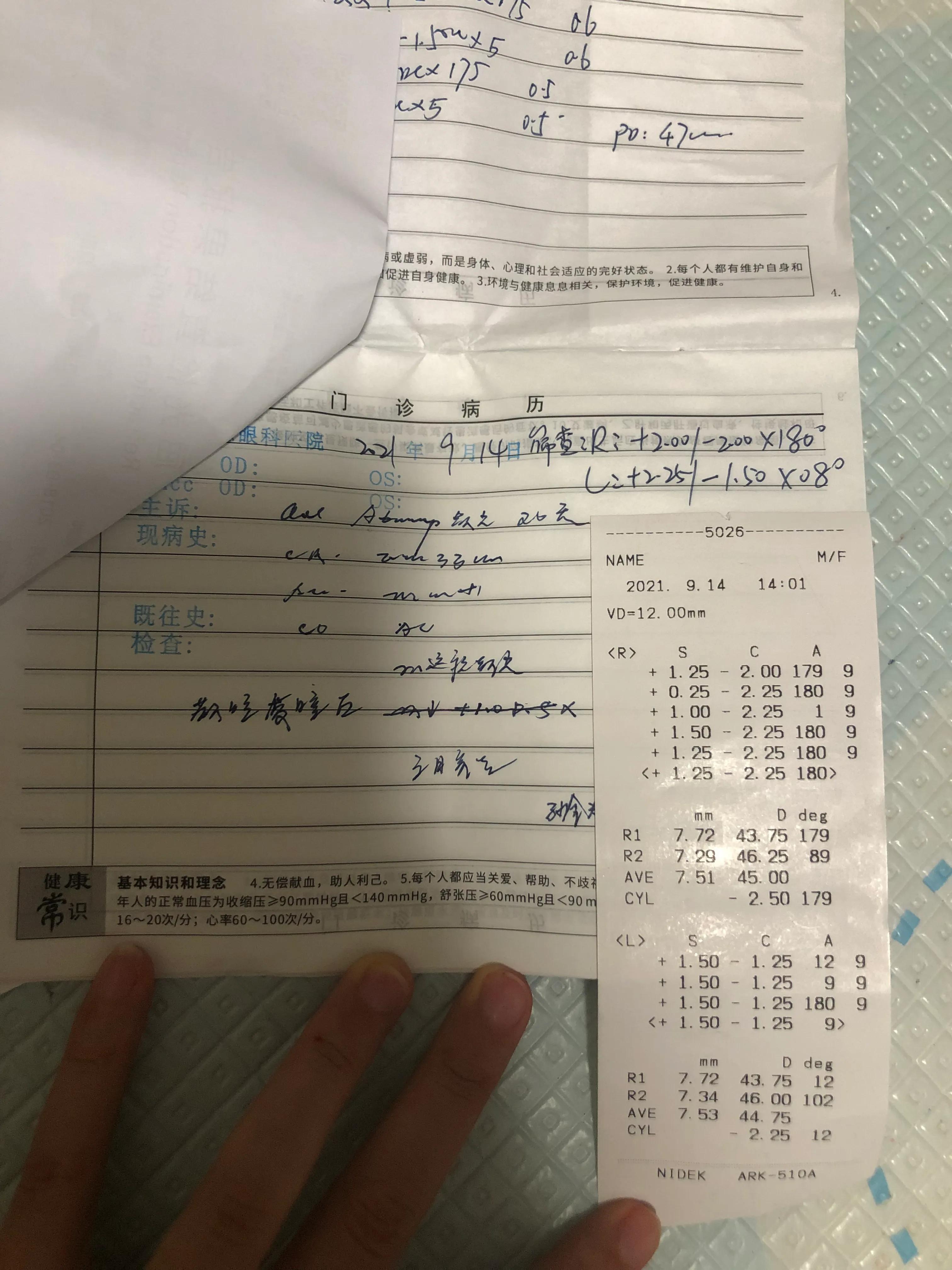 幼儿园体检散光3.0严重吗,3岁体检散光